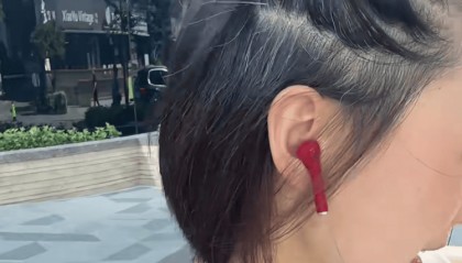 女演员打白发针2个月收效甚微,没人管管可疑的新疗法?